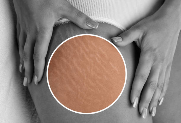 Стрии снимка