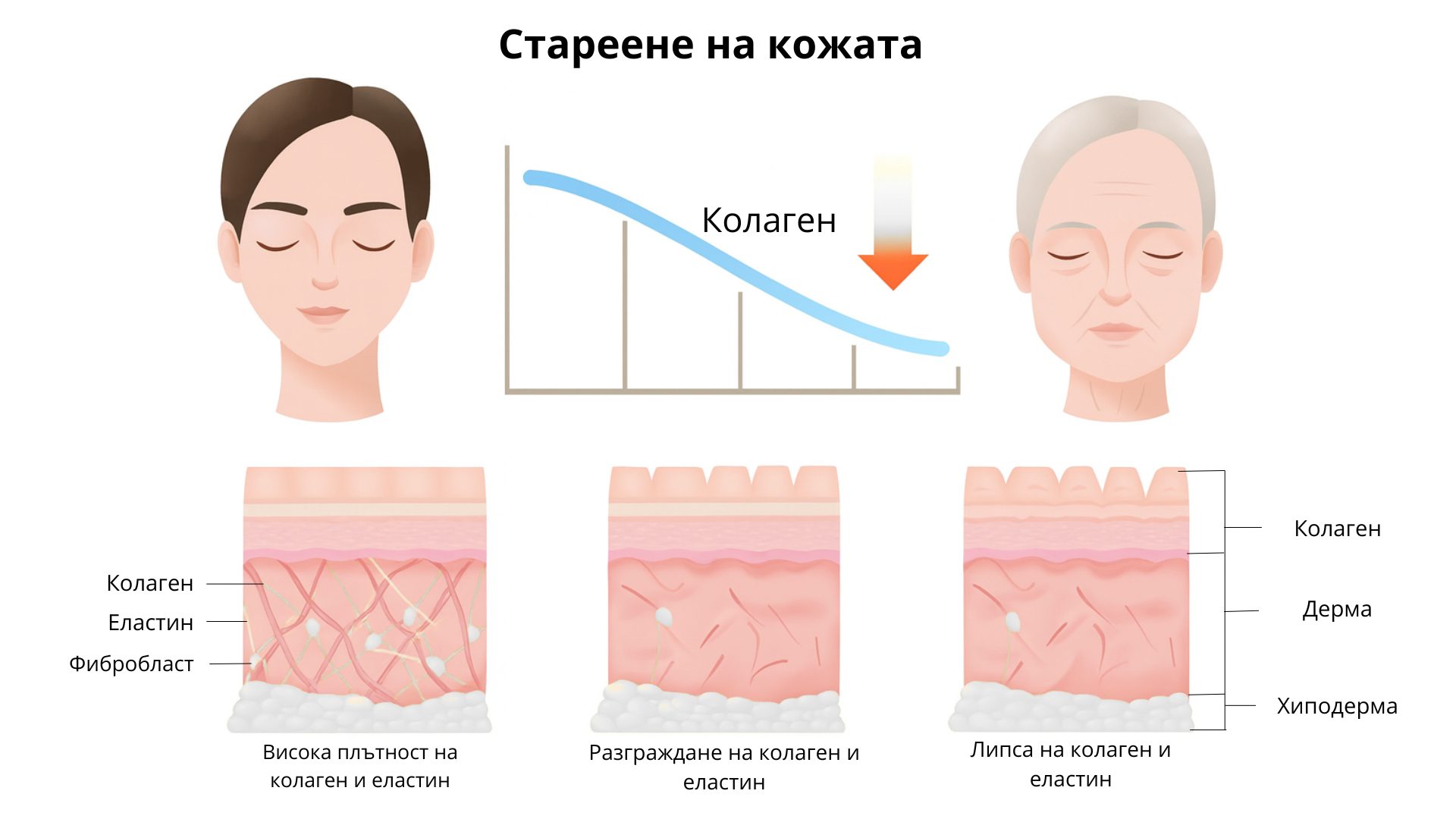 Процес на стареене на кожата – намаляване на колагена и загуба на еластичност
